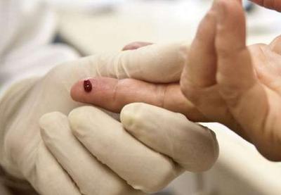 Brasileiro passa a testar negativo para HIV após tratamento experimental