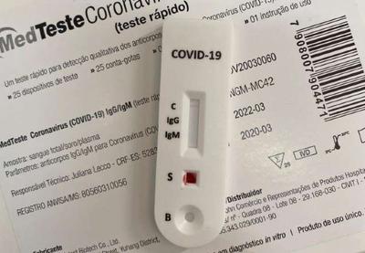 9 em cada 10 farmácias não têm estrutura para realizar testes da Covid-19