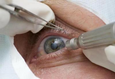 Partículas de coronavírus são encontradas em olhos de pacientes
