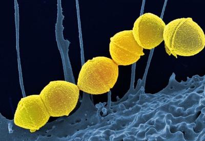 Síndrome do choque tóxico: o que é a bactéria mortal com surto de casos no Japão