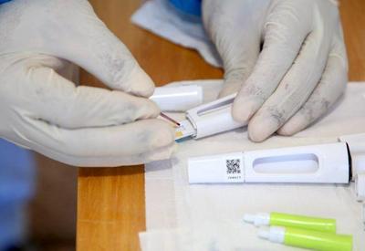 Anvisa recebe novos pedidos de registro para teste de varíola dos macacos