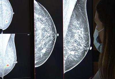 Inteligência Artificial tem precisão de 97% no diagnóstico de câncer de mama