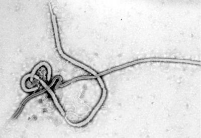 Após 4 mortes, Guiné declara novo surto de ebola