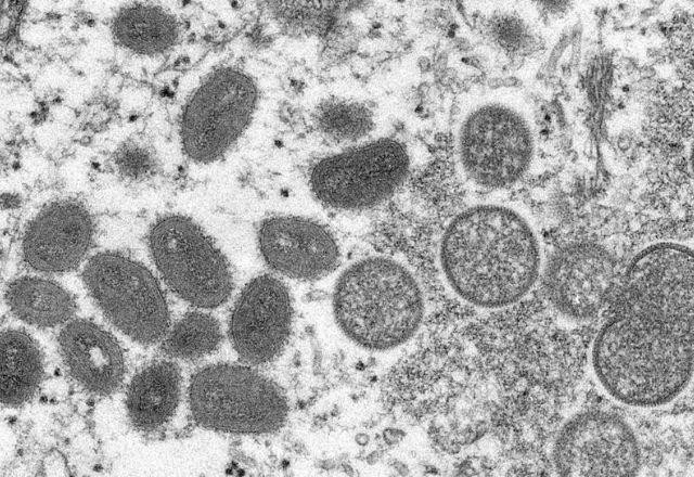 Surto de varíola dos macacos não deve se tornar pandemia, diz OMS