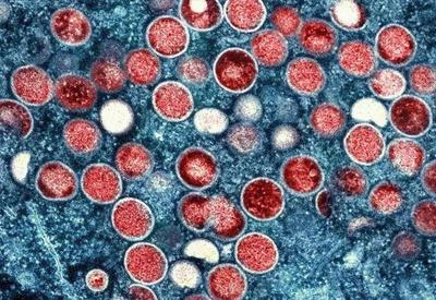 Número de casos de varíola dos macacos chega a 6,8 mil no Brasil
