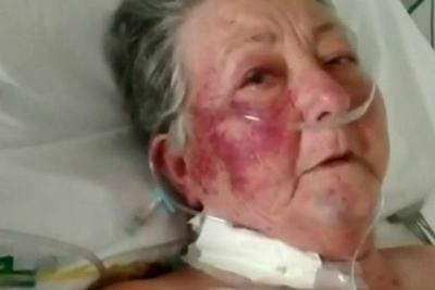 Enfermeiro agride idosa de 78 anos em cama de UTI