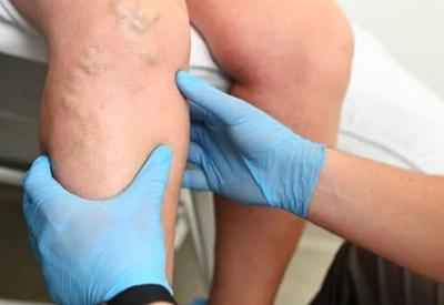 Brasil bate recorde de hospitalizações por trombose venosa