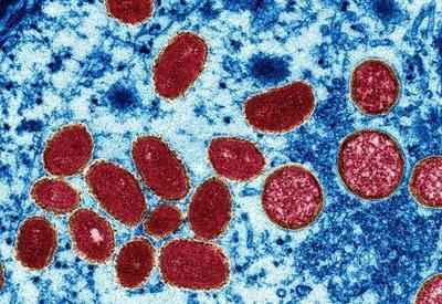 Fiocruz investiga possível contaminação de monkeypox por superfícies