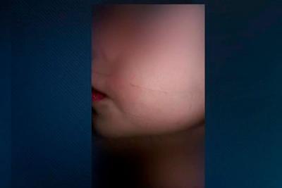 Professora cola fita adesiva em boca de criança; Mãe registra caso na polícia