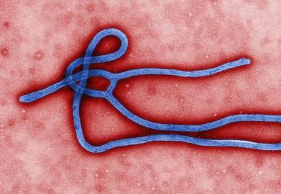 Vírus semelhante ao ebola é encontrado na Bolívia