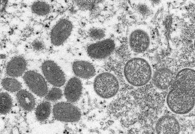 OMS confirma mais de 5 mil casos de varíola dos macacos no mundo