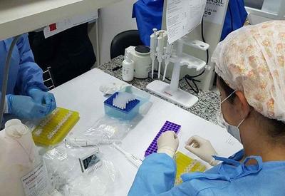 Pesquisadores da UFMG criam teste que detecta covid-19 pela urina
