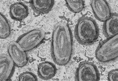 Varíola dos macacos e hepatite "misteriosa": entenda as novas doenças