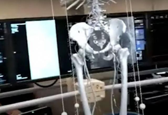 Hospital usa holograma durante cirurgia no Rio Grande do Sul