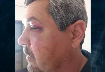 Engenheiro brasileiro é brutalmente agredido em Portugal