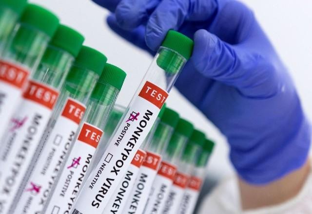 EUA confirmam primeiro caso de varíola dos macacos em grávida