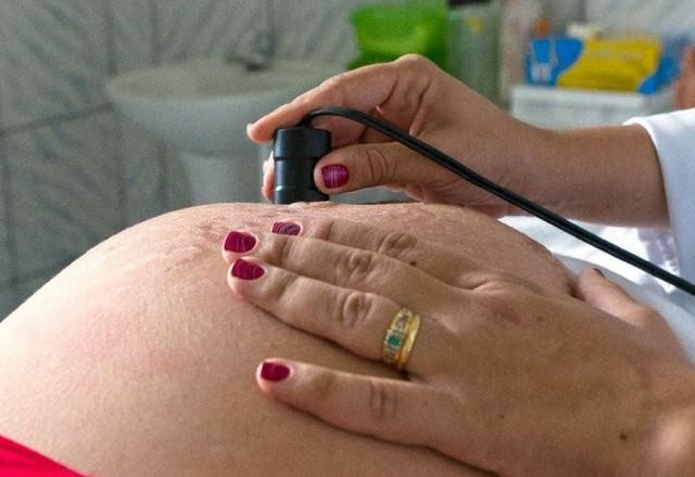 Número de cesáreas voltou a subir no Brasil em 2022