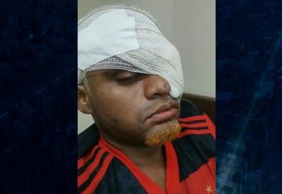 Família protesta após jovem autista perder o olho a golpes de canivete